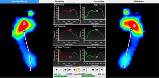 Pressure Pad Gait Analysis for Orthotics Pressure Pad Gait Analysis for Orthotics
